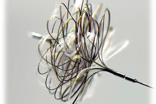 Polyembo Secures Fresh Funding to Advance “Scrunchy” — a Minimalist Fix for a Complex Vascular Problem